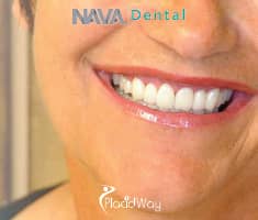Slider image (2) Nava Dental Care
